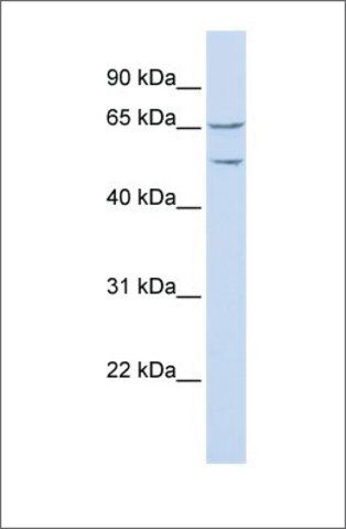 Anti-TTYH1 antibody produced in rabbit