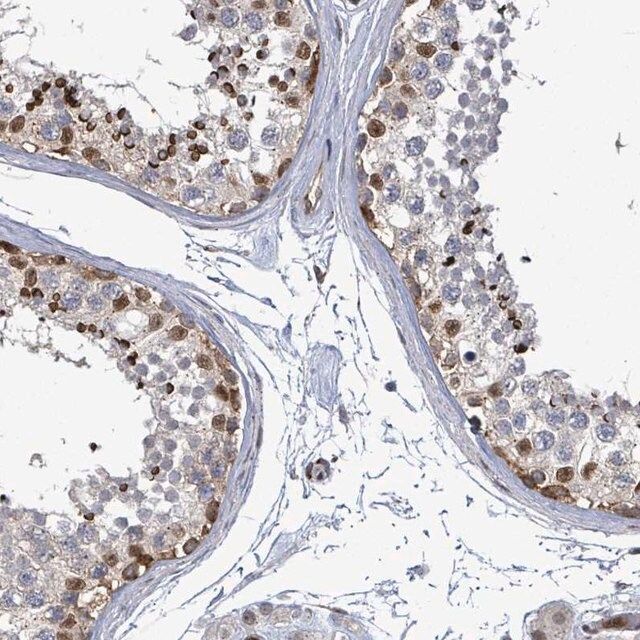 Anti-TUSC1 antibody produced in rabbit