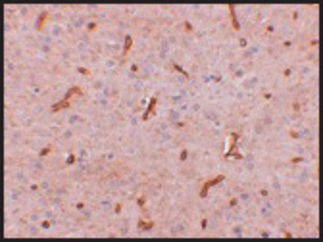 Anti-TWA1 antibody produced in rabbit