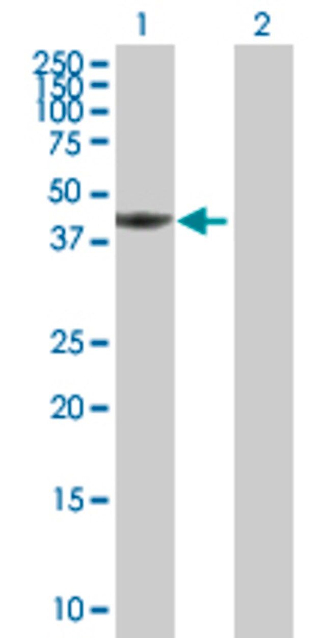 Anti-TWF1 antibody produced in mouse