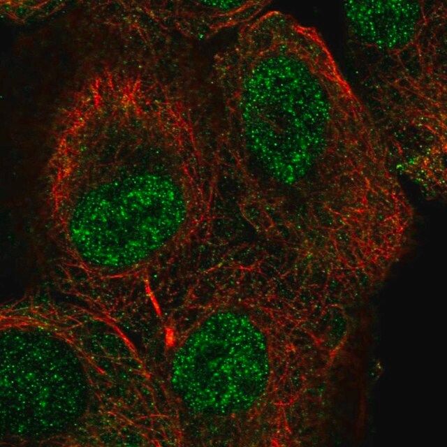 Anti-TUT1 antibody produced in rabbit