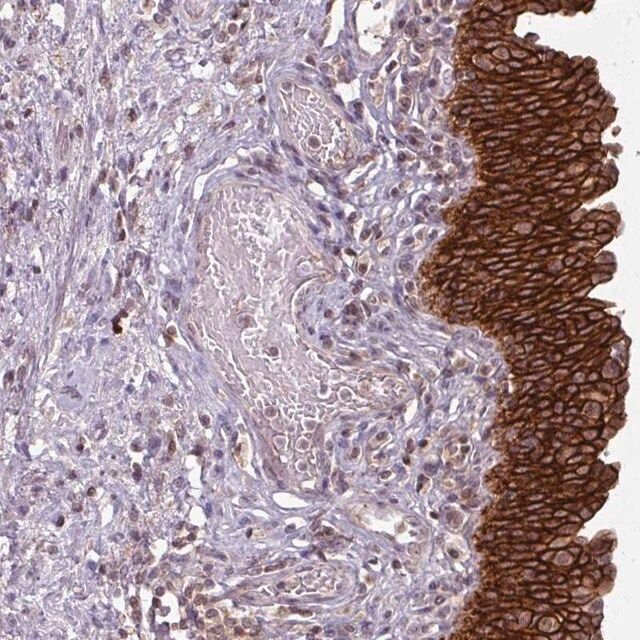 Anti-TUSC3 antibody produced in rabbit