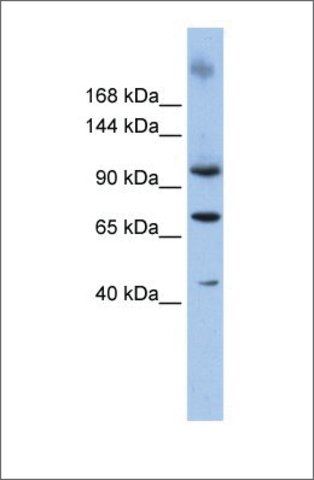 Anti-TUT1 antibody produced in rabbit