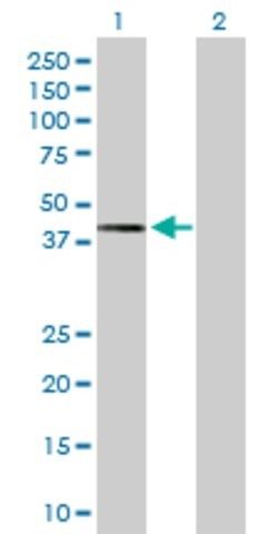 Anti-TWF2 antibody produced in rabbit