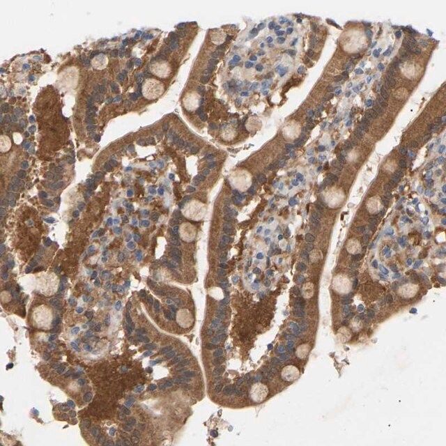 Anti-TPMT antibody produced in rabbit