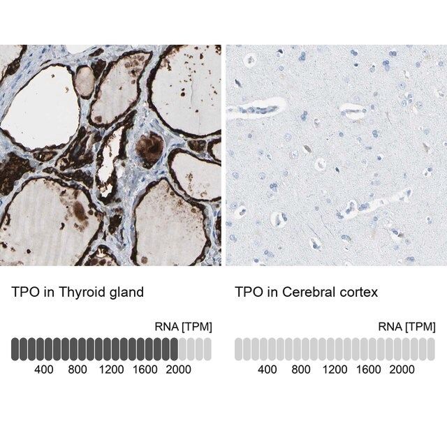 Anti-TPO antibody produced in rabbit