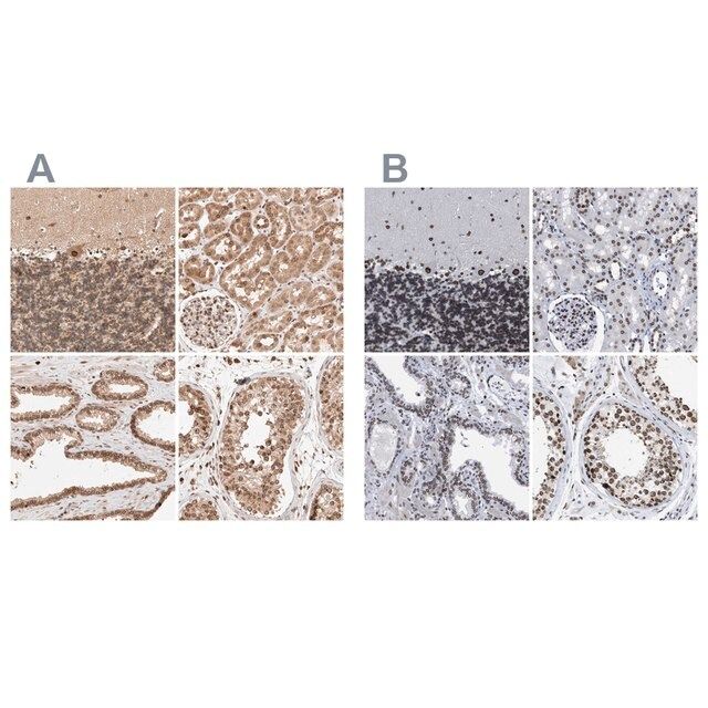 Anti-TPR antibody produced in rabbit