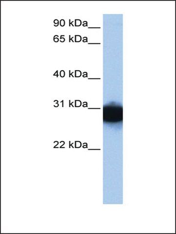 Anti-TPI1 antibody produced in rabbit