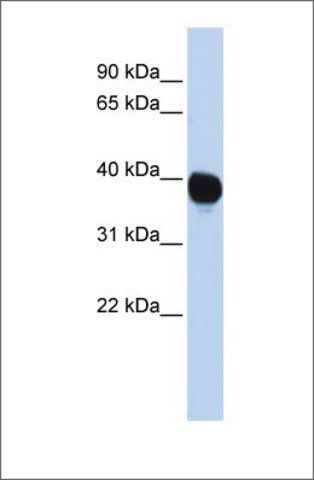 Anti-TPST2 antibody produced in rabbit