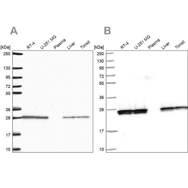 Anti-TPI1 antibody produced in rabbit