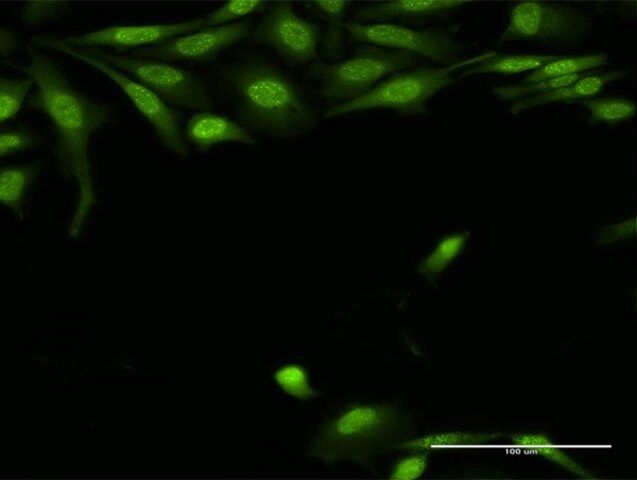 Anti-TRADD antibody produced in rabbit