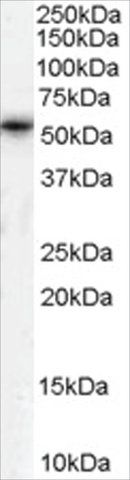 Anti-TPTE/PTEN2 antibody produced in goat