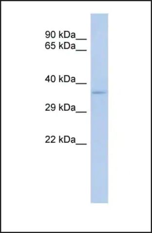 Anti-TRADD antibody produced in rabbit