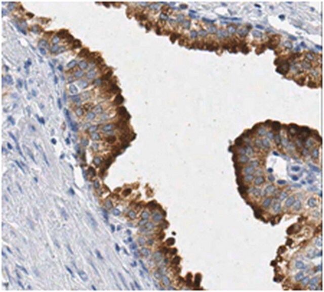 Anti-Transmembrane Prostatic Acid Phosphatase Antibody/TMPAP, clone 3G10.1