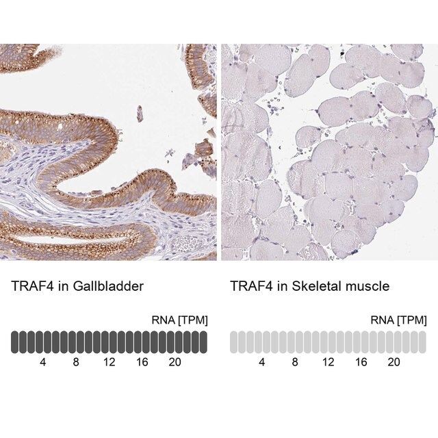 Anti-TRAF4 antibody produced in rabbit