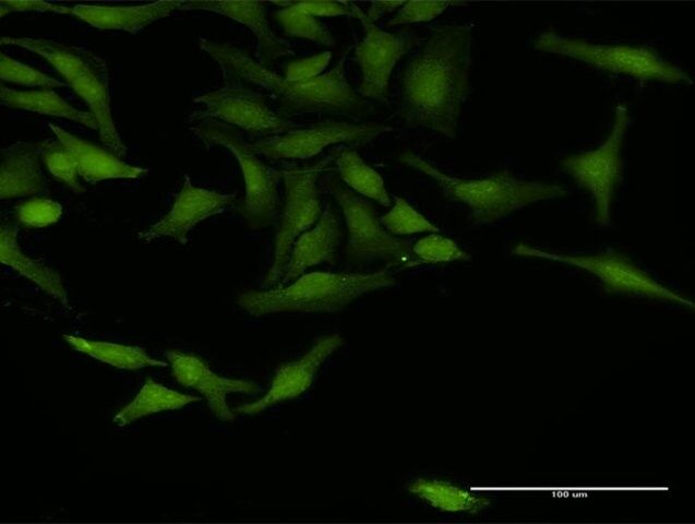 Anti-TRAF4 antibody produced in rabbit