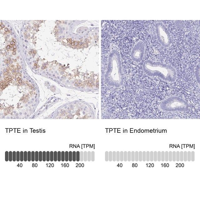 Anti-TPTE antibody produced in rabbit