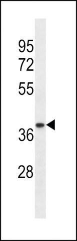 ANTI-TRA2A (CENTER) antibody produced in rabbit