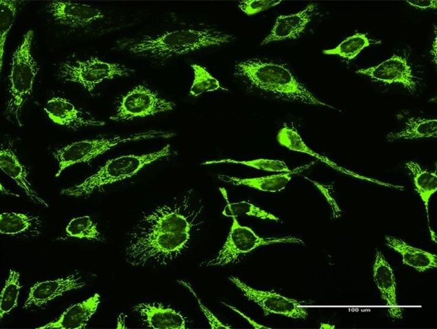 Anti-TRAP1 antibody produced in rabbit