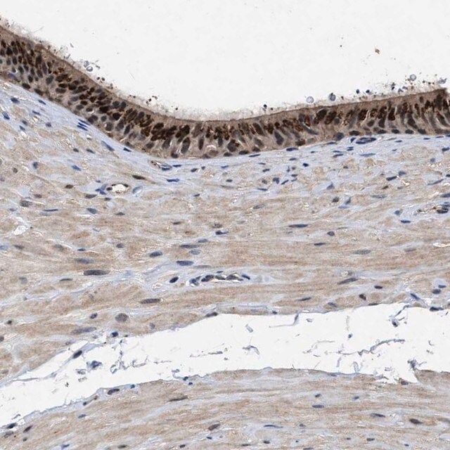 Anti-TPST2 antibody produced in rabbit