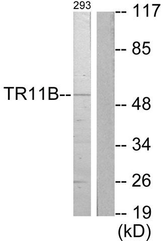 Anti-TR11B antibody produced in rabbit