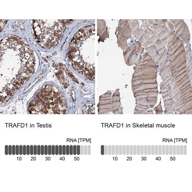 Anti-TRAFD1 antibody produced in rabbit