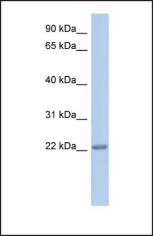 Anti-TRAPPC5 antibody produced in rabbit