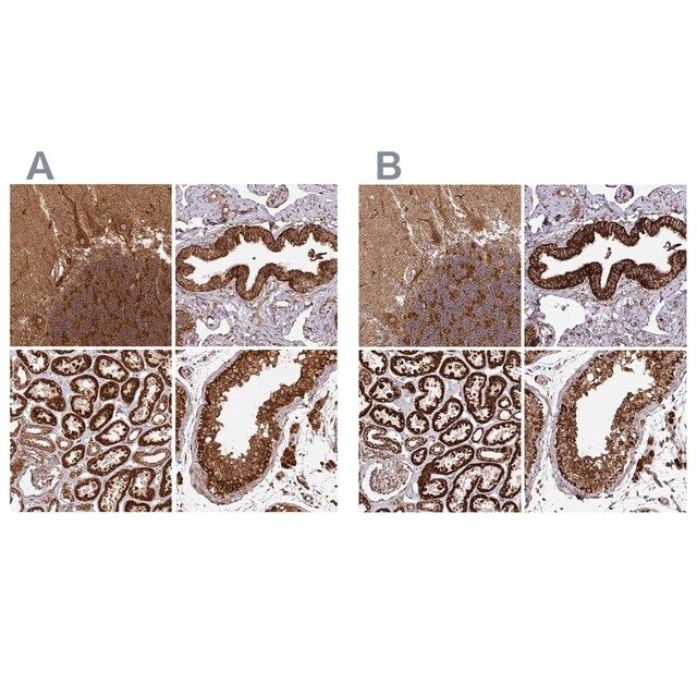 Anti-TRAP1 antibody produced in rabbit