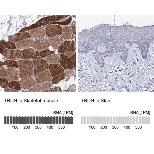 Anti-TRDN antibody produced in rabbit