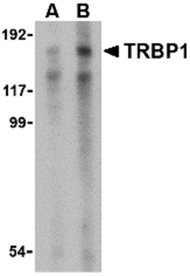 Anti-TRBP1 antibody produced in rabbit