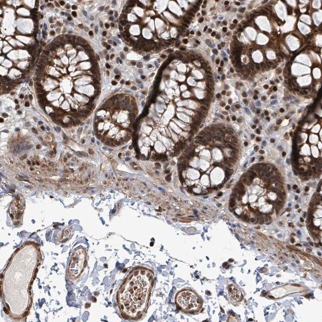 Anti-TRDMT1 antibody produced in rabbit