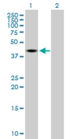 Anti-TRDMT1 antibody produced in mouse