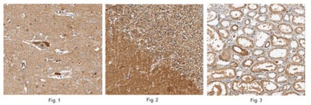 Anti-TRAPPC1 Antibody