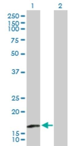 Anti-TRAPPC3 antibody produced in mouse