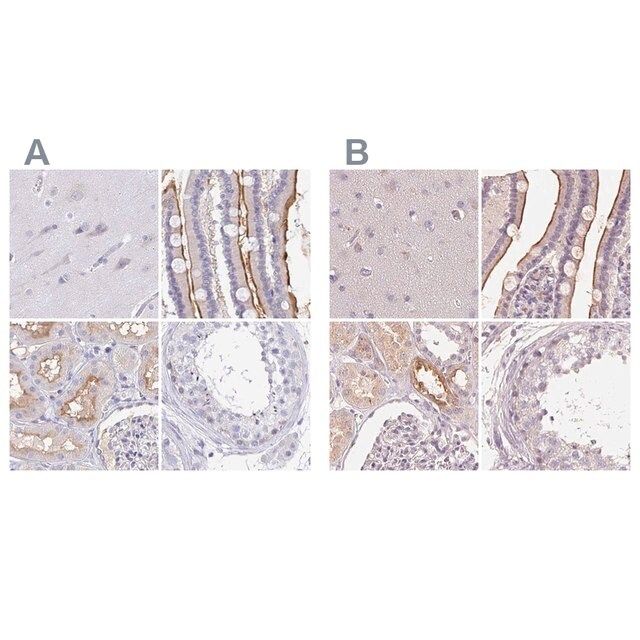 Anti-TREH antibody produced in rabbit