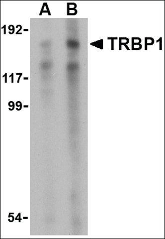 Anti-TRBP1 antibody produced in rabbit