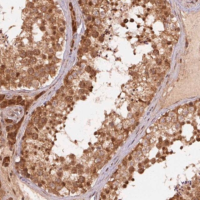 Anti-TREML4 antibody produced in rabbit