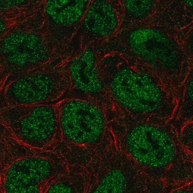 Anti-TRERF1 antibody produced in rabbit