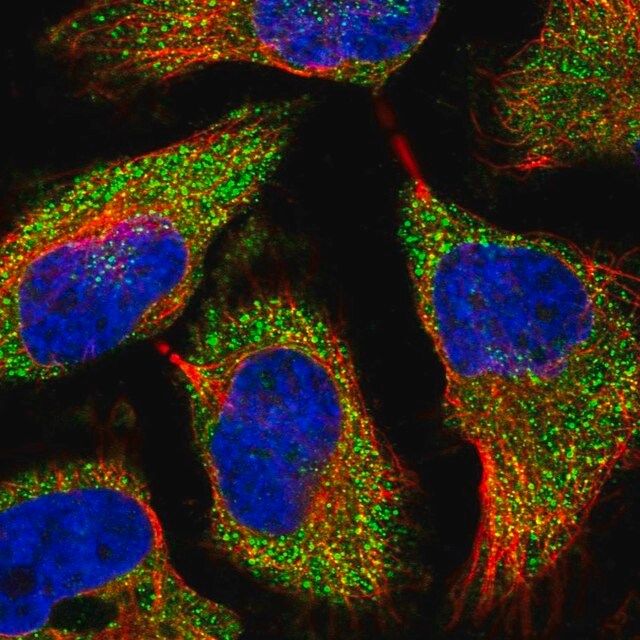 Anti-TREX1 antibody produced in rabbit