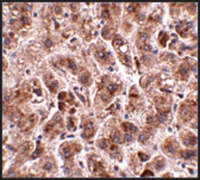 Anti-TREX2 antibody produced in rabbit