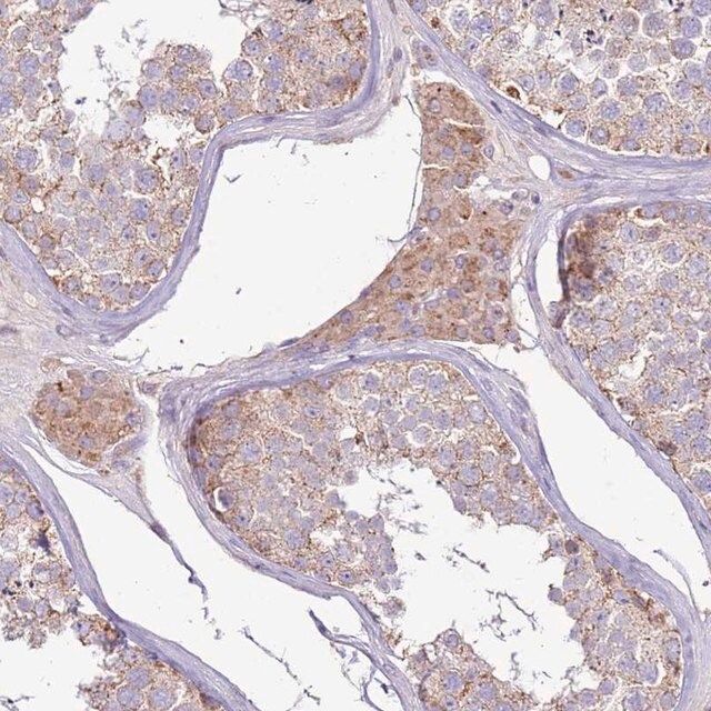 Anti-TRAPPC4 antibody produced in rabbit