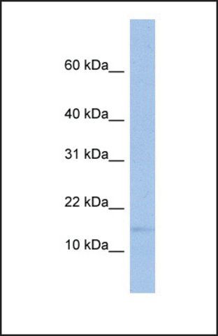 Anti-TRAPPC2 antibody produced in rabbit