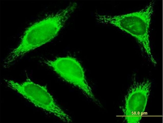 Anti-TRDD3 antibody produced in mouse