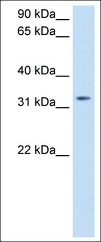 Anti-TRH antibody produced in rabbit