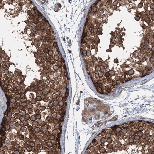 Anti-TRAPPC8 antibody produced in rabbit