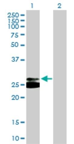 Anti-TREM1 antibody produced in mouse