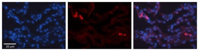 Anti-TRIB1 antibody produced in rabbit