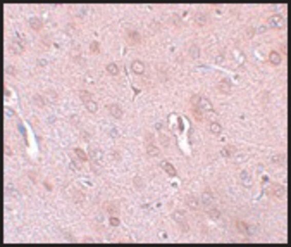 Anti-TRESK antibody produced in rabbit