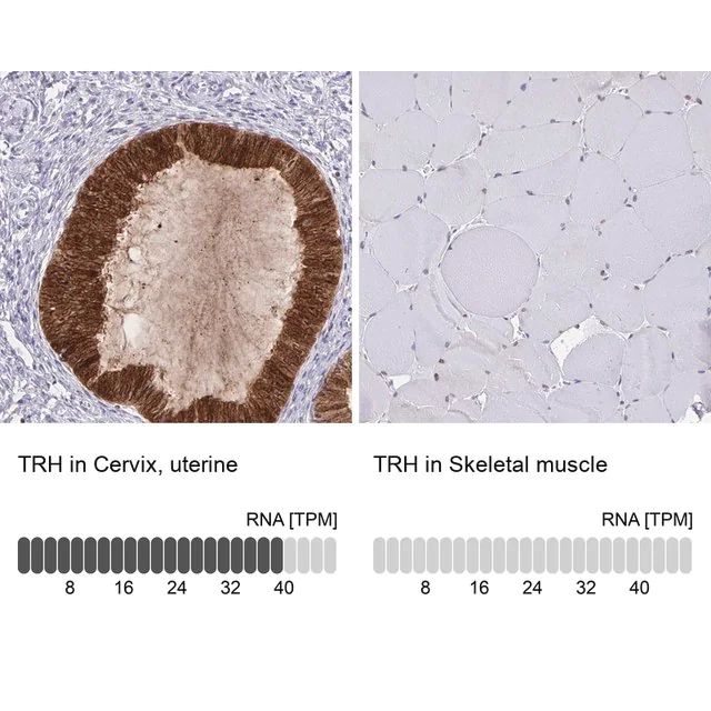 Anti-TRH antibody produced in rabbit