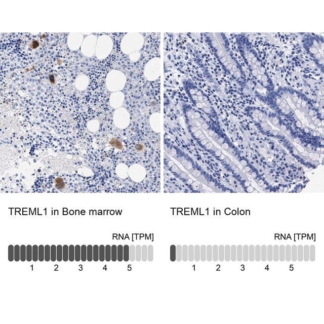 Anti-TREML1 antibody produced in rabbit